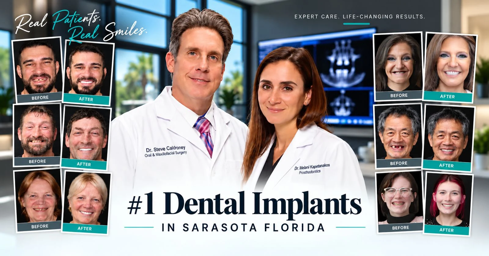 Dr. Steve Caldroney and Dr. Melani Kapetanakos with real patient before and after smile transformations — #1 Dental Implants in Sarasota Florida